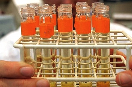DOPING SCANDALS: TO BE OR NOT TO BE?