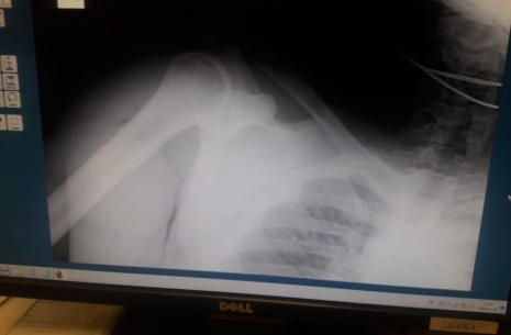 Dmitry Silaev is recovering!